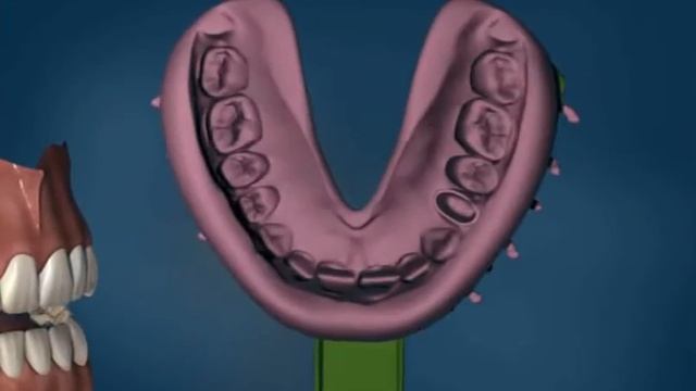 Зубные Коронки все типы - ДокторСтом, установка зубных коронок г. Краснодар смотреть онлайн