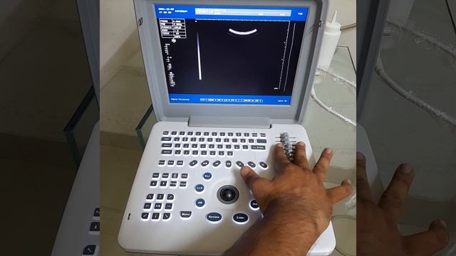 Function Apollo 7 part1 Ultrasound machine Best price in Pakistan смотреть онлайн