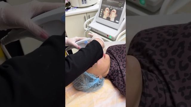 Смас лифтинг на аппарате Альтера смотреть онлайн