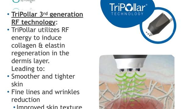 Geneo+U Training Movie