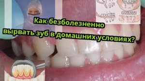 Как безболезненно вырвать зуб в домашних условиях?