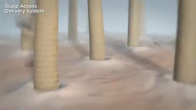 How it works Scalp Access Delivery System Technology by Nioxin смотреть онлайн