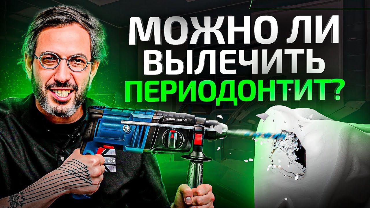 Воспаление корня зуба. Как лечить периодонтит и когда можно НЕ удалять зуб? смотреть онлайн