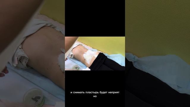 Перевязка после сеанса гирудотерапии смотреть онлайн