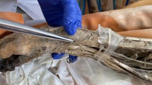 Артерии верхней конечности