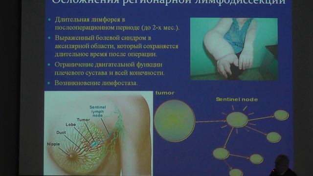 Доклад глав. хирурга-онколога Минздрава Украины Ивана Смоланки смотреть онлайн
