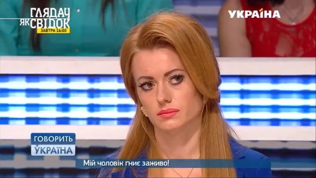 Мой муж сгнивает заживо (полный выпуск) | Говорить Україна смотреть онлайн