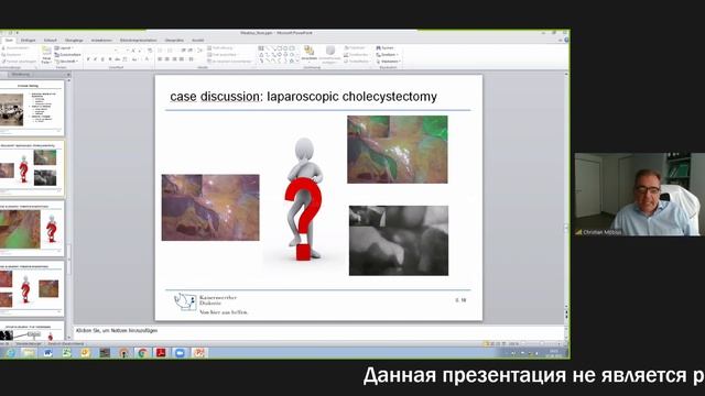Инновационные технологии визуализации в лапароскопической хирургии с индоцианином зеленым (ICG) смотреть онлайн