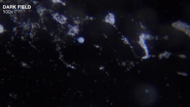 Killing Bacteria Under The Microscope With Alcohol - RIP Bacteria Colony смотреть онлайн