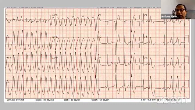 Case Base Studies in ECG смотреть онлайн