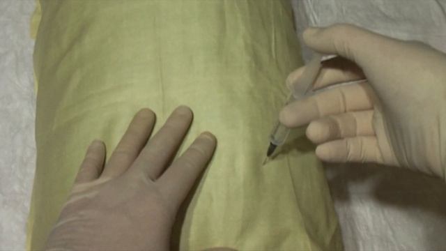 Как правильно сделать внутримышечный укол самому себе. Автоматический инъектор "Spasilen". смотреть онлайн