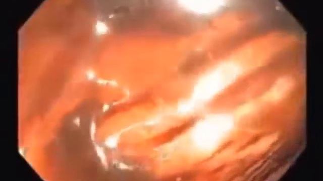 Есть решение.... Это все поправимо... Волнует? Ставьте + наберём 100,расскажу! Ваша Светлана Яковен смотреть онлайн