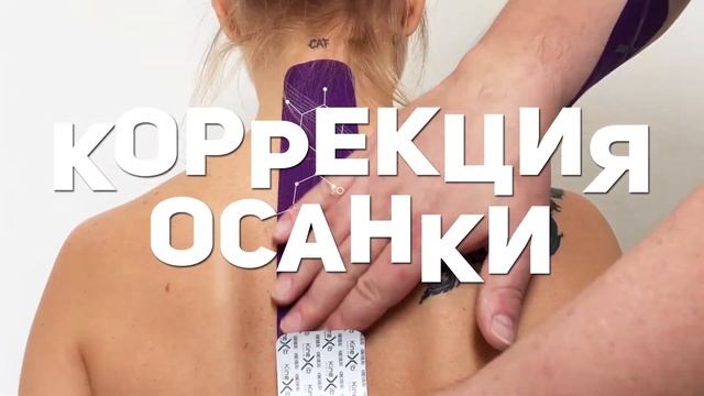 Реклама Коррекции Осанки смотреть онлайн