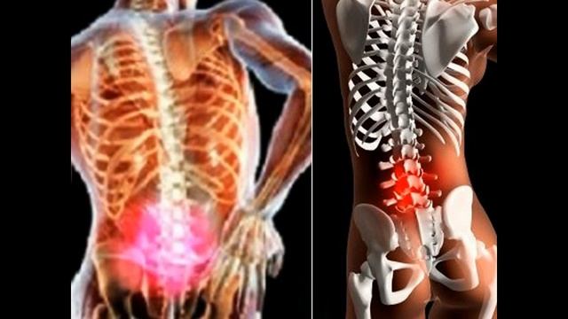 Рецепт мази на основе лаврового листа от боли в спине смотреть онлайн