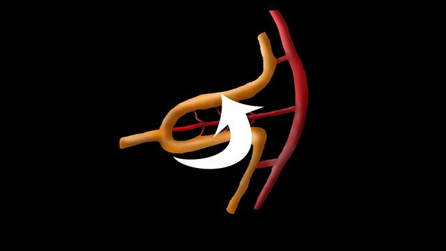 Embryological Rotation of the Midgut смотреть онлайн