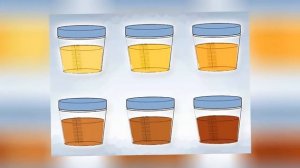 О ЧЁМ ГОВОРИТ ЦВЕТ МОЧИ?!