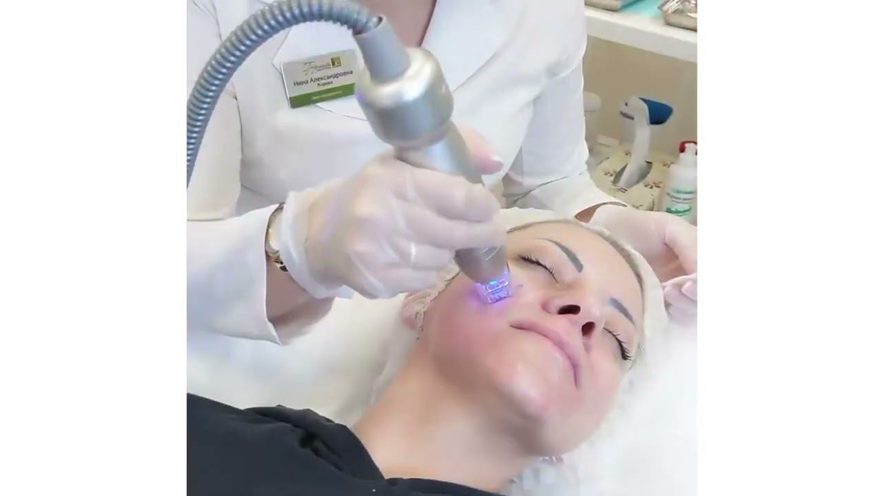 Игольчатый RF лифтинг Scarlet смотреть онлайн