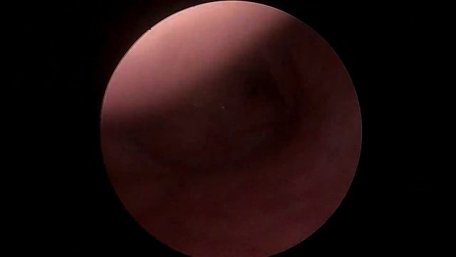 Майстер-клас: Методика ендоскопічного огляду носової порожнини та носоглотки смотреть онлайн