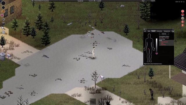 The Hinkle family has A Really CD DA start in Project Zomboid смотреть онлайн