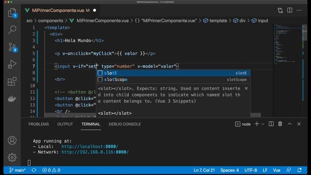 ☘ Curso en Vue 3: Condicionales v-if y v-show #13 смотреть онлайн