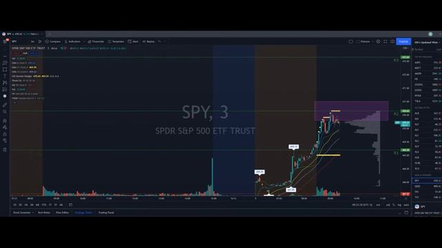 LiVe Options Trading - 11/5/2021 смотреть онлайн