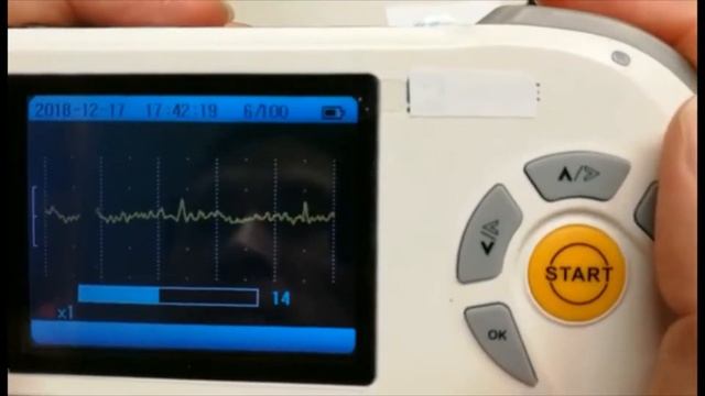 Facelake FL40 ECG Monitor With Real Time PC review смотреть онлайн