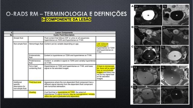 O-RADS (Ovarian-Adnexal Reporting And Data System) - Ressonância Magnética