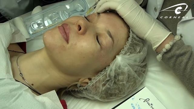 Папулы в переорбитальной области