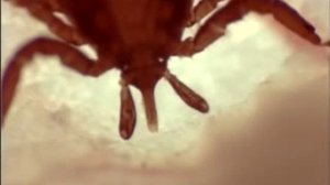 Как клещ проникает под кожу