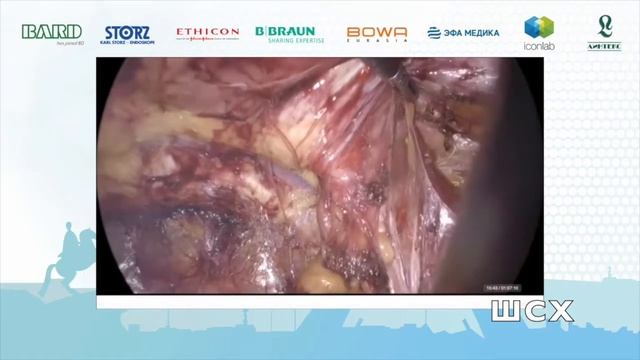 B. Ramshaw Management of complications смотреть онлайн