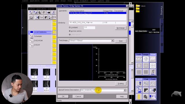MRI FAT/WATER FRACTION - MADE EASY смотреть онлайн