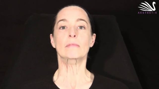 9 - Botox gegen Halsfalten | Dr. Günther смотреть онлайн