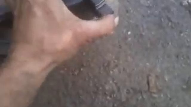 Результат чистки до и после смотреть онлайн