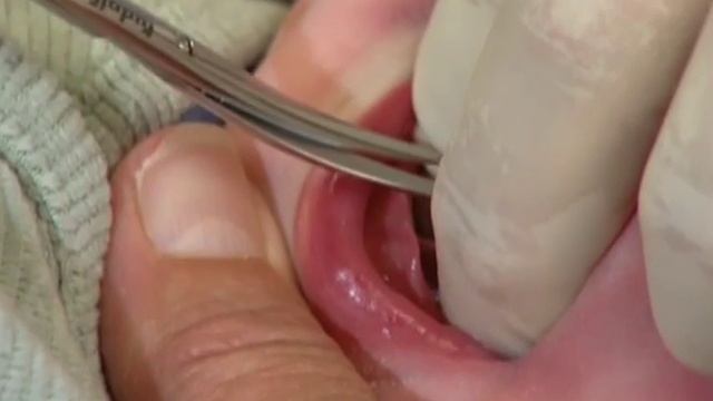 Breas is Best_Rus смотреть онлайн