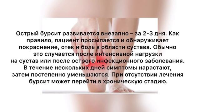 Бурсит смотреть онлайн