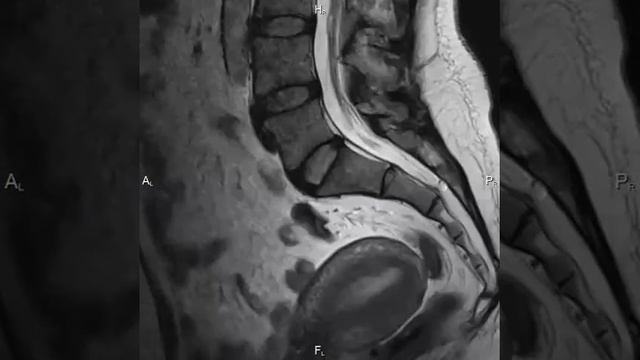 плодное яйцо 2 смотреть онлайн