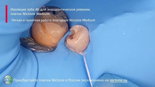 Изоляция зуба 45 для эндодонтическое ревизии, платок Nictone Medium 4K смотреть онлайн