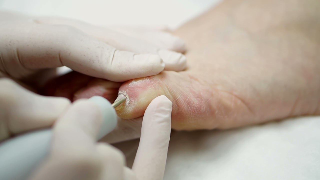 Уход за стопами зимой. смотреть онлайн