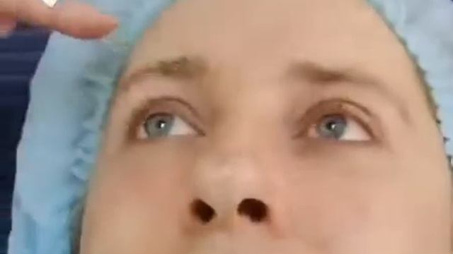 Красота и молодость кожи лица смотреть онлайн