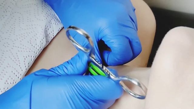 Микродермал