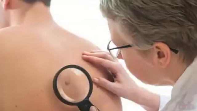Домашние средства которые могут помочь избавиться от Прыщей на спине смотреть онлайн