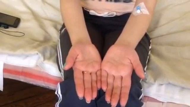 Гіпергідроз