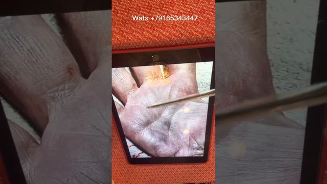 Линия солнца на ладошке смотреть онлайн