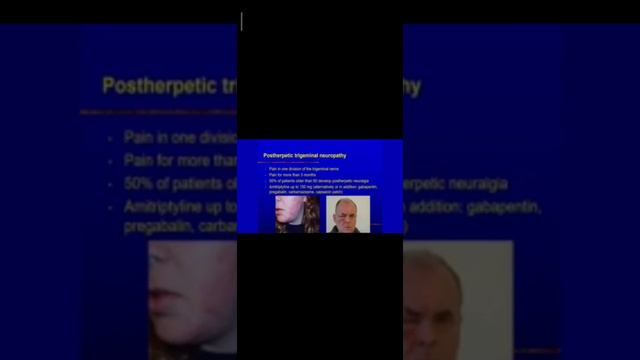 #конференция #лицевая боль (3часть) 25.сентября 2021 смотреть онлайн