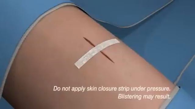 3M Steri-Strips™ Skin Closure Application | 3M Critical & Chronic Care Solutions смотреть онлайн