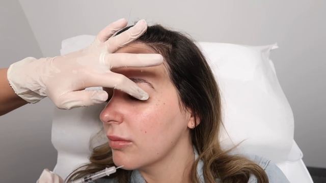 Getting Botox + Brow Lift! * Before & After (VLOG) смотреть онлайн