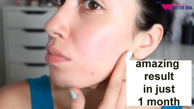 Bioaqua Super Anti-Acne cream in UAE смотреть онлайн