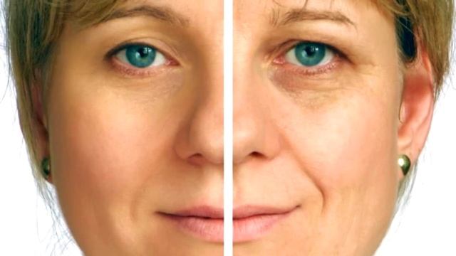 EXPERT Альтернатива Уколам Красоты смотреть онлайн