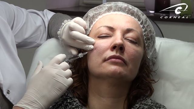 Фотоэпиляция: часто задаваемые вопросы