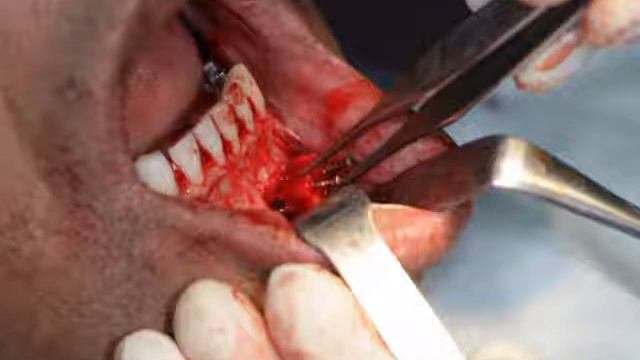 implant смотреть онлайн